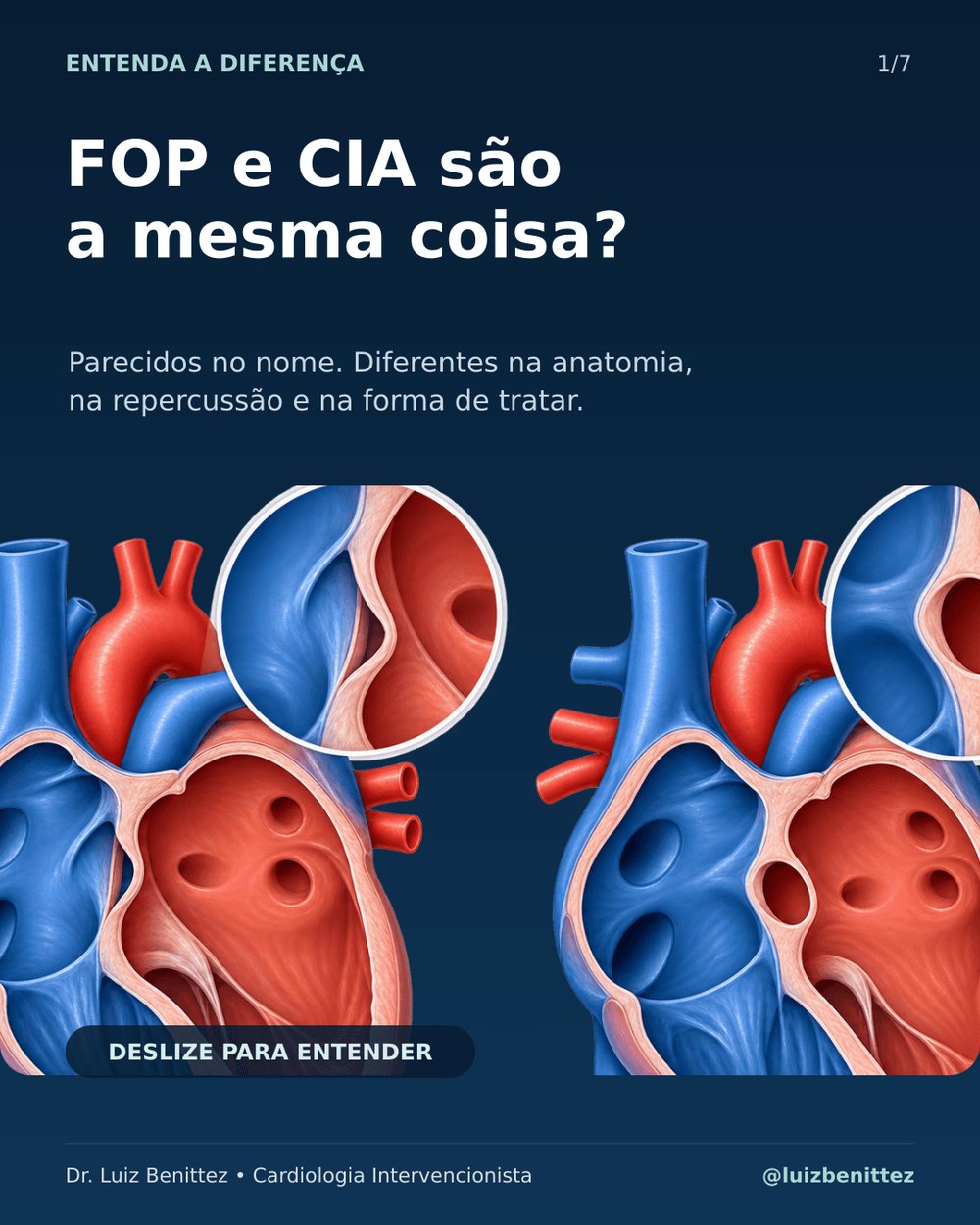 FOP e CIA: por que não são a mesma coisa